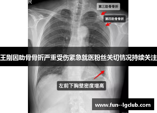 王刚因肋骨骨折严重受伤紧急就医粉丝关切情况持续关注 王刚因肋骨骨折严重受伤紧急就医粉丝关切情况持续关注